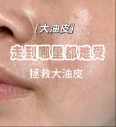 油皮踩雷无数！这款Stridex洗面奶洗的干净不拔干，巨舒服！